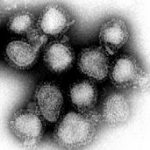 flu 150x150
